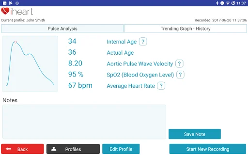 iHeart Internal Age APK ڈاؤن لوڈ کریں – اپنی صحت اور عمر کی پیمائش کریں - Screenshot 9