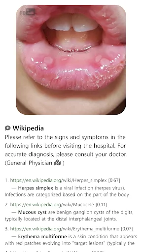 Model Dermatol ڈاؤن لوڈ کریں – جلد کی بیماریوں کی تشخیص ایپ - Screenshot 15