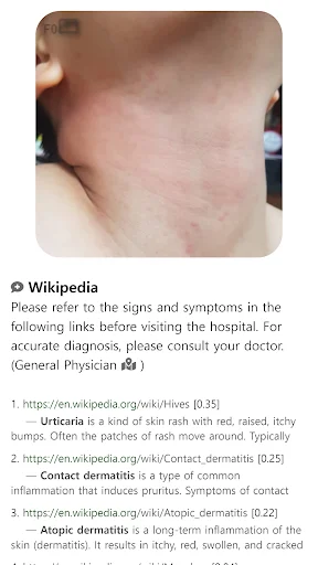 Model Dermatol ڈاؤن لوڈ کریں – جلد کی بیماریوں کی تشخیص ایپ - Screenshot 12