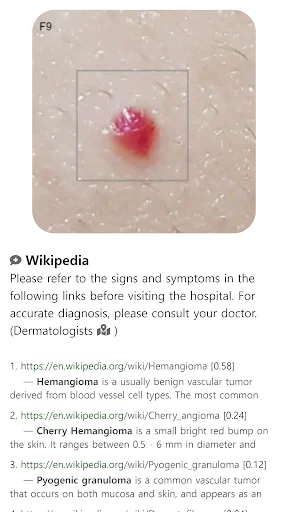 Model Dermatol ڈاؤن لوڈ کریں – جلد کی بیماریوں کی تشخیص ایپ - Screenshot 11
