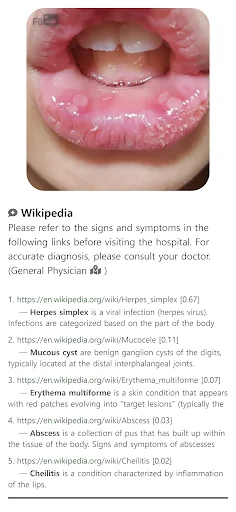 Model Dermatol ڈاؤن لوڈ کریں – جلد کی بیماریوں کی تشخیص ایپ - Screenshot 8