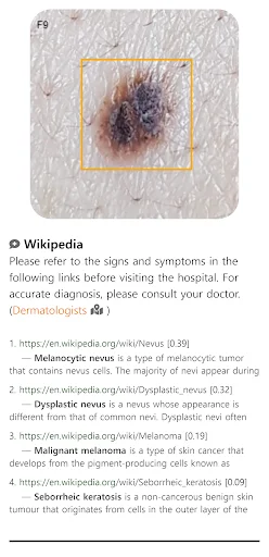 Model Dermatol ڈاؤن لوڈ کریں – جلد کی بیماریوں کی تشخیص ایپ - Screenshot 3