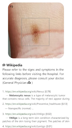 Model Dermatol ڈاؤن لوڈ کریں – جلد کی بیماریوں کی تشخیص ایپ - Screenshot 10