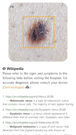 Model Dermatol ڈاؤن لوڈ کریں – جلد کی بیماریوں کی تشخیص ایپ - Screenshot 9