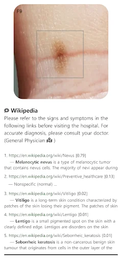 Model Dermatol ڈاؤن لوڈ کریں – جلد کی بیماریوں کی تشخیص ایپ - Screenshot 4